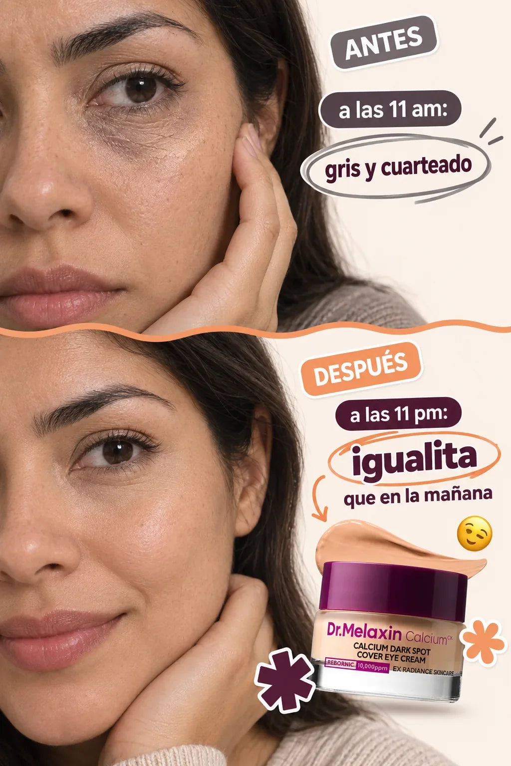 Dr.Melaxin Crema Cubre Ojeras — antes despues